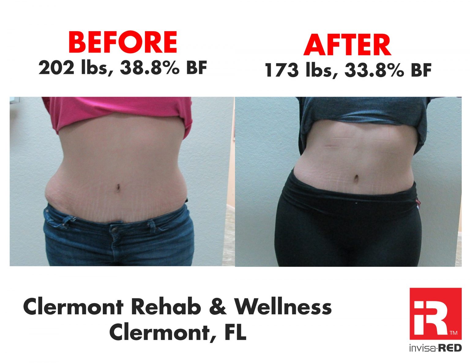 Invisa-RED Weight Loss & Skin Rejuvenation | Cloud 9 Medi Spa